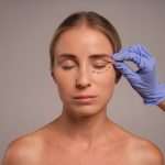 woman preparing cosmetic surgery 1